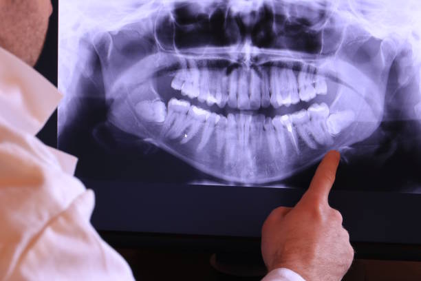 Best Emergency Dental Care for Broken or Chipped Teeth in Felton, DE